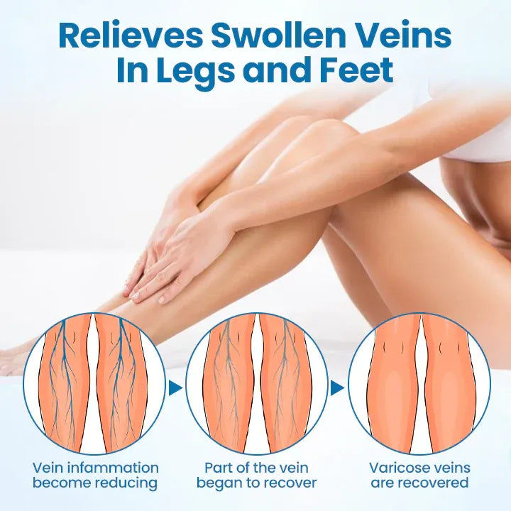 VeinGuard Herbal Spray-✅ Clinically proven to eliminate varicose veins in just 7 days!